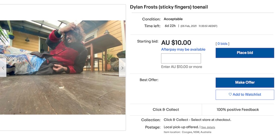 Screenshot of Dylan Frost's toenail listing on eBay